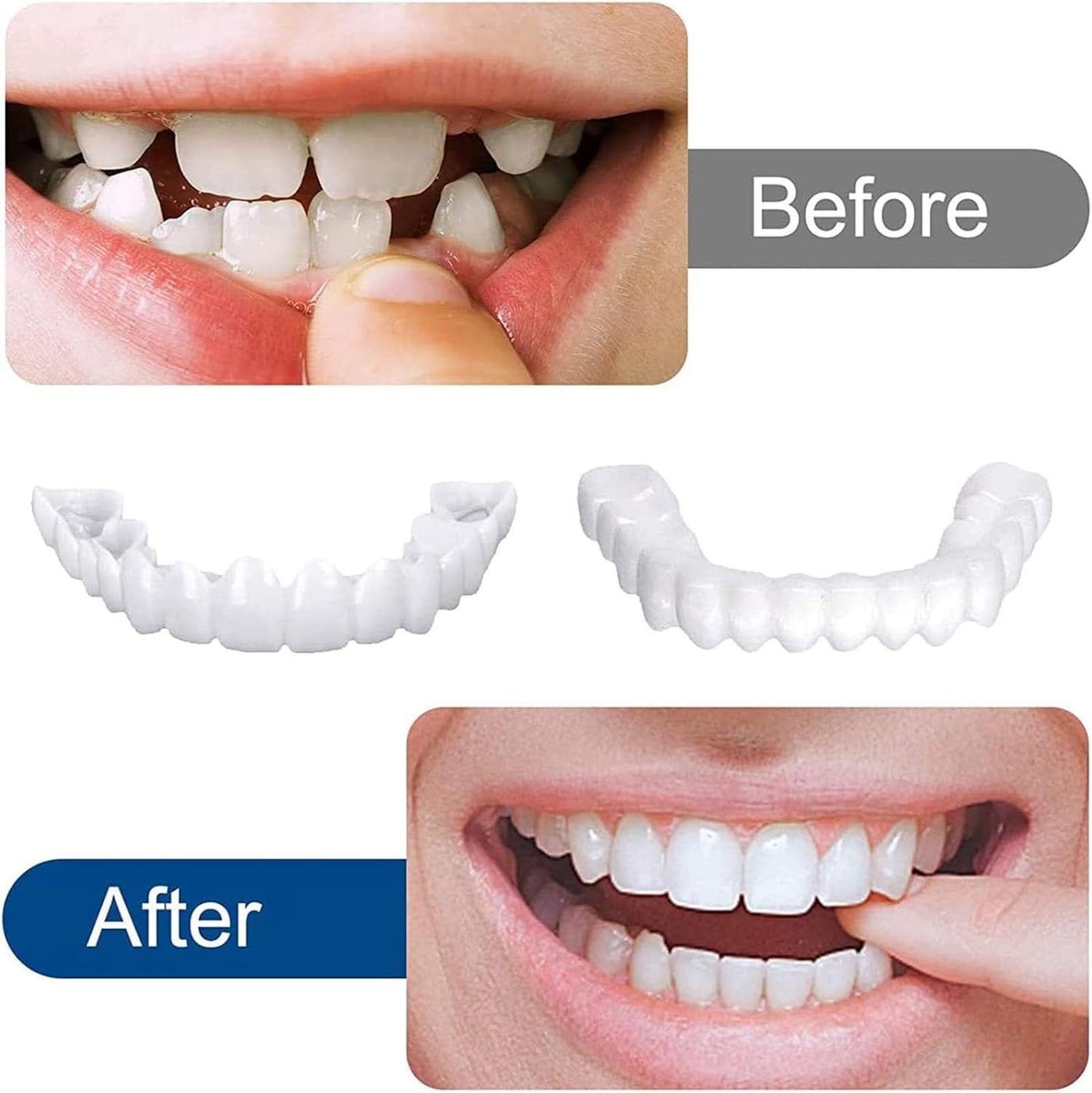 Instant and Confident on Smile Fit Flex Cosmetic Teeth Denture Teeth